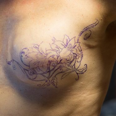 1.Brustkrebstattoo-Tag 2016; das Motiv wird angepasst; Fru Tattoo, Uelzen; Foto: Shenevra Punk Pics