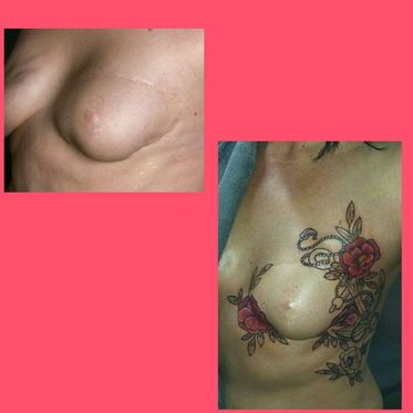 Brustkrebstattoo-Tag 2016, vorher/nachher bei Tintenstich Tattoo, Bonn ; Foto: www.PhotoArtClaus.jimdo.com